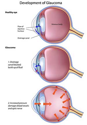 Dog eye problems